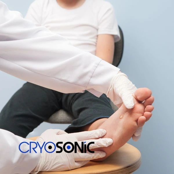 Are you looking for fast effective wart removal Contact us today Woking
